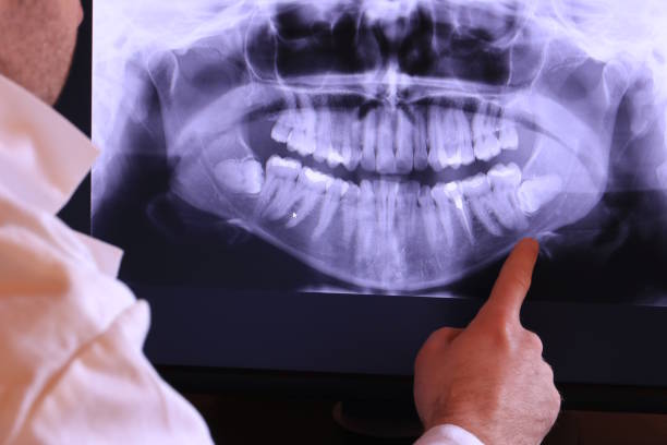 Best Emergency Dental Filling Replacement  in Columbia City, IN
