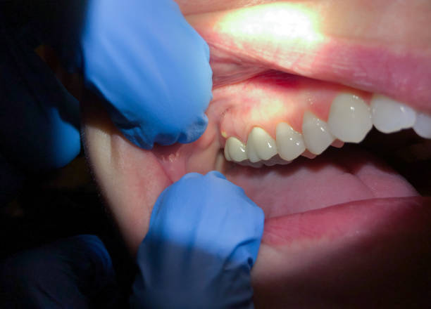 Best Emergency Dentist Near Me  in Columbia City, IN