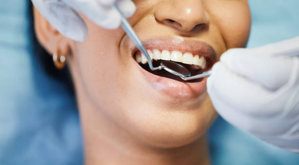 Best Chipped Tooth Repair Near Me  in Columbia City, IN
